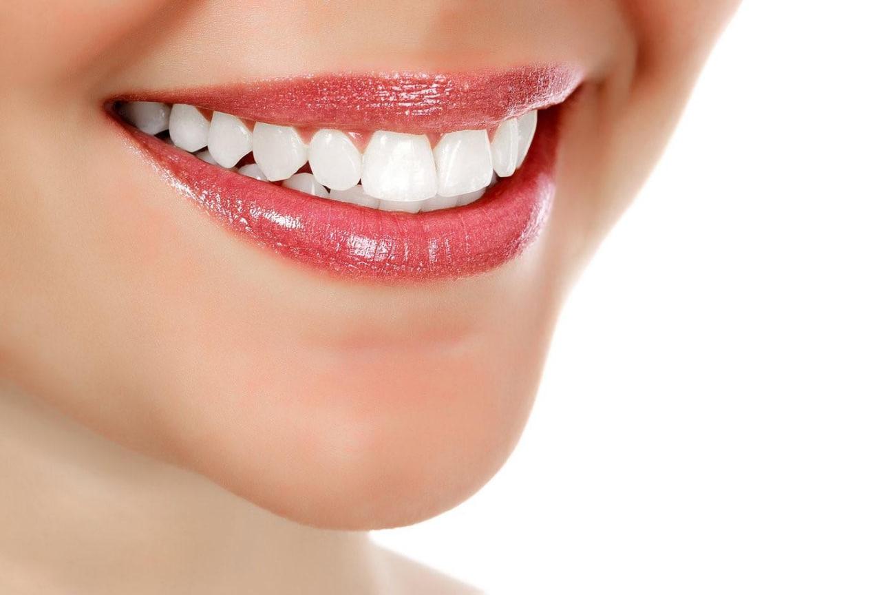  ۴ روش پزشکی و ۱۲ روش‌ خانگی سفید کردن دندان 